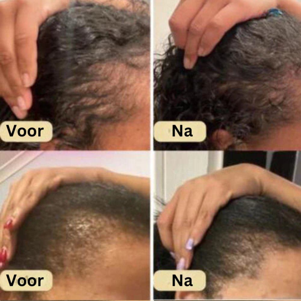 Gabi ™ | Vegan Haargroei Olie