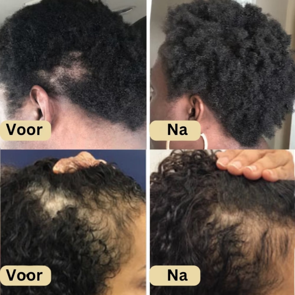 Gabi ™ | Vegan Haargroei Olie